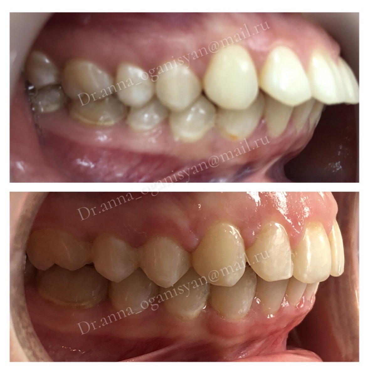 img_7615